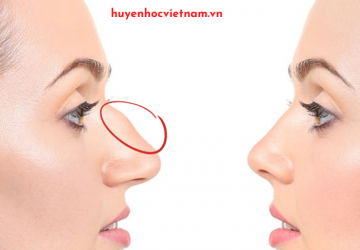 5 Nét tướng phụ nữ lận đận tình duyên