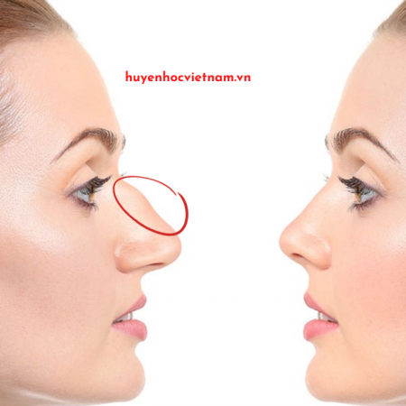 5 Nét tướng phụ nữ lận đận tình duyên